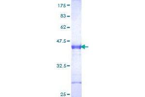 Image no. 1 for Dickkopf Homolog 1 (DKK1) (AA 81-180) protein (GST tag) (ABIN1351649)