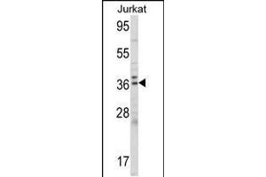 Western blot analysis of ALAD Antibody (C-term) (ABIN390809 and ABIN2841046) in Jurkat cell line lysates (35 μg/lane). (ALAD 抗体  (C-Term))