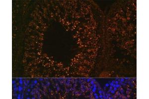 Immunofluorescence analysis of Rat testis using LDHAL6B Polyclonal Antibody at dilution of 1:100. (LDHAL6B 抗体)