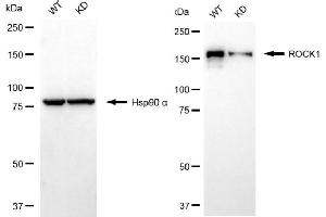 Western blotting analysis using ROCK1 antibody (ABIN7800201).