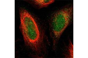Immunofluorescent staining of human cell line U-2 OS shows positivity in nucleus & cytoplasm. (Plexin A1 抗体)