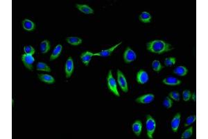 Immunofluorescent analysis of A549 cells using ABIN7154060 at dilution of 1:100 and Alexa Fluor 488-congugated AffiniPure Goat Anti-Rabbit IgG(H+L) (GGT1 抗体  (AA 13-225))