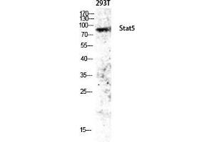 Western Blot (WB) analysis of 293T lysis using Stat5 antibody.