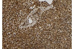ABIN6261480 and ABIN6279422 at 1/100 staining Mouse spleen tissue by IHC-P.