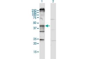 Western Blot analysis of KCNN4 expression in transfected 293T cell line by KCNN4 MaxPab polyclonal antibody. (KCNN4 抗体  (AA 1-427))