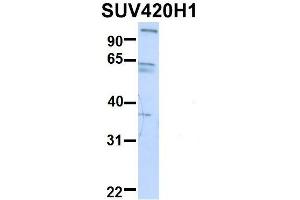 Western Blotting (WB) image for anti-Suppressor of Variegation 4-20 Homolog 1 (SUV420H1) (Middle Region) antibody (ABIN2775877)