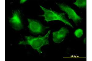 Immunofluorescence of monoclonal antibody to B2M on HeLa cell. (beta-2 Microglobulin 抗体  (AA 1-119))