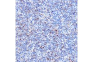 Immunohistochemistry of paraffin-embedded mouse spleen using NOTCH3 antibody (ABIN6134401, ABIN6144738, ABIN6144739 and ABIN6217553) at dilution of 1:100 (40x lens). (NOTCH3 抗体  (C-Term))