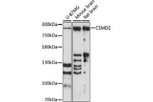 Western blot analysis of extracts of various cell lines, using CSMD2 antibody (ABIN7266537) at 1:1000 dilution. (CSMD2 抗体  (AA 2050-2150))