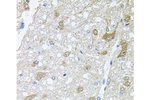 Immunohistochemistry of paraffin-embedded Rat brain using RAPSN Polyclonal Antibody at dilution of 1:100 (40x lens). (RAPSN 抗体)