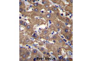 UGDH Antibody (C-term) immunohistochemistry analysis in formalin fixed and paraffin embedded human liver tissue followed by peroxidase conjugation of the secondary antibody and DAB staining. (UGDH 抗体  (C-Term))