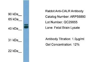 WB Suggested Anti-CALR  Antibody Titration: 0.