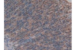 Detection of AMH in Rat Intestine Tissue using Polyclonal Antibody to Anti-Mullerian Hormone (AMH)