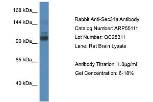 Western Blotting (WB) image for anti-SEC31 Homolog A (SEC31A) (N-Term) antibody (ABIN2786062) (SEC31A 抗体  (N-Term))