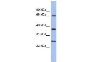 HORMAD2 antibody used at 1 ug/ml to detect target protein. (HORMAD2 抗体  (Middle Region))
