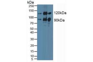 Figure. (PKC epsilon 抗体  (AA 403-672))
