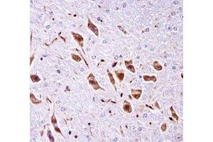 PAK3 antibody immunohistochemistry analysis in formalin fixed and paraffin embedded mouse brain tissue. (PAK3 抗体  (AA 124-152))