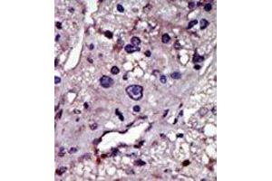 Image no. 1 for anti-Cytidine Monophosphate (UMP-CMP) Kinase 1, Cytosolic (CMPK1) (N-Term) antibody (ABIN360613) (Cytidine Monophosphate (UMP-CMP) Kinase 1, Cytosolic (CMPK1) (N-Term) 抗体)