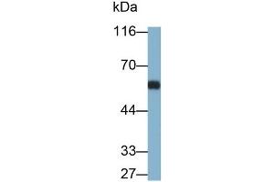 Detection of OCTN1 in Rat Thymus lysate using Polyclonal Antibody to Organic Cation/Ergothioneine Transporter (OCTN1) (SLC22A4 抗体  (AA 42-141))