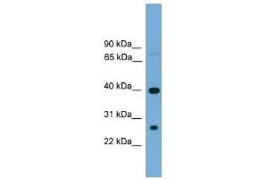 TREML2 antibody used at 0. (TREML2 抗体  (N-Term))