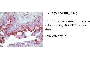 Image no. 2 for anti-Metalloproteinase Inhibitor 2 (TIMP2) (Middle Region) antibody (ABIN2787968) (TIMP2 抗体  (Middle Region))