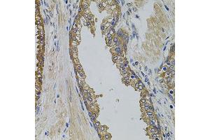 Immunohistochemistry of paraffin-embedded human prostate using PIK3C3 antibody (ABIN2737377) at dilution of 1:100 (40x lens). (PIK3C3 抗体)