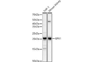Western blot analysis of extracts of various cell lines, using GPX1 Rabbit mAb (ABIN7267434) at 1:12000 dilution. (Glutathione Peroxidase 1 抗体)