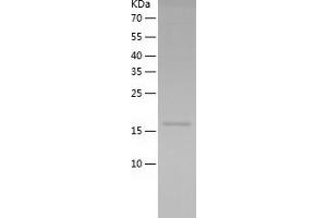 FGF9 Protein (AA 4-208) (His tag)