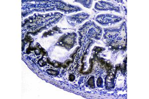 IHC analysis of Bcl-2 using anti-Bcl-2 antibody . (Bcl-2 抗体  (AA 118-165))