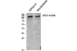 Western Blot (WB) analysis of HepG2-UV, Mouse Brain cells using Acetyl-CRM1 (K568) Polyclonal Antibody. (XPO1 抗体  (acLys568))