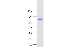 Western Blotting (WB) image for Cytochrome P450, Family 3, Subfamily A, Polypeptide 5 (CYP3A5) protein (Myc-DYKDDDDK Tag) (ABIN2712776)