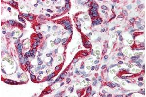 Human Placenta: Formalin-Fixed, Paraffin-Embedded (FFPE) (Calnexin 抗体  (AA 504-593))