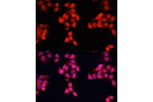 Immunofluorescence analysis of HeLa cells using ENO3 antibody (ABIN7266960) at dilution of 1:100. (ENO3 抗体  (AA 1-190))