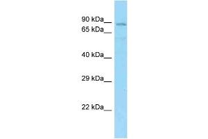 WB Suggested Anti-SHCBP1L Antibody Titration: 1. (SHCBP1L 抗体  (N-Term))