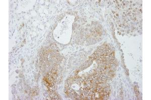 Immunohistochemistry (IHC) image for anti-Protein Arginine Methyltransferase 5 (PRMT5) (C-Term) antibody (ABIN7448743) (PRMT5 抗体  (C-Term))