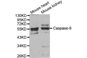 Western blot analysis of extracts of mouse heart and kidney tissue, using CASP9 antibody. (Caspase 9 抗体)