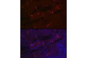 Immunofluorescence analysis of rat spleen cells using CD25 Rabbit pAb (ABIN3017118, ABIN3017119, ABIN3017120 and ABIN6219963) at dilution of 1:100 (40x lens). (CD25 抗体)