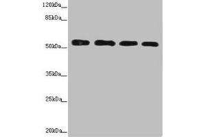 Western blot All lanes: CALCOCO2 antibody at 3. (CALCOCO2 抗体  (AA 137-446))
