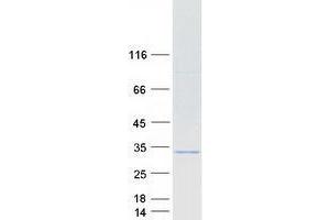Western Blotting (WB) image for Vacuolar-sorting Protein SNF8 (SNF8) protein (Myc-DYKDDDDK Tag) (ABIN2735161)