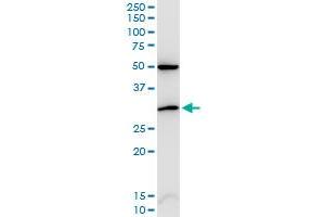 CDKN1B monoclonal antibody (M02), clone 2F4. (CDKN1B 抗体  (AA 100-198))