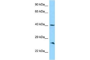 WB Suggested Anti-ABI1 Antibody Titration: 1. (ABI1 抗体  (C-Term))