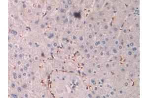 Immunohistochemistry (IHC) image for anti-2',5'-Oligoadenylate Synthetase 1, 40/46kDa (OAS1) (AA 74-165) antibody (ABIN7435079)