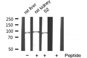 Western Blotting (WB) image for anti-Catenin (Cadherin-Associated Protein), beta 1, 88kDa (CTNNB1) (N-Term) antibody (ABIN6260494)