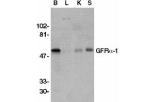 Image no. 2 for anti-GDNF Family Receptor alpha 1 (GFRA1) (AA 369-382) antibody (ABIN201472) (GFRA1 抗体  (AA 369-382))