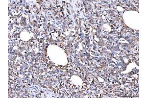 IHC analysis of FHL2 using anti-FHL2 antibody (ABIN7600782). (FHL2 抗体  (AA 234-279))