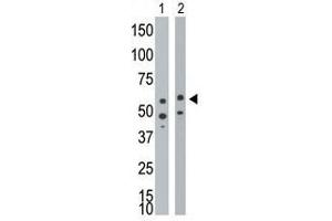 Image no. 1 for anti-Bone Morphogenetic Protein Receptor 1A (BMPR1A) (Middle Region) antibody (ABIN357375) (BMPR1A 抗体  (Middle Region))