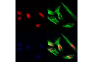 HDGFRP3 Antibody staining Hela cells by IF/ICC. (HDGFRP3 抗体  (Internal Region))