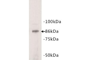 Western Blotting (WB) image for anti-Signal Transducer and Activator of Transcription 3 (Acute-Phase Response Factor) (STAT3) (N-Term) antibody (ABIN1854975) (STAT3 抗体  (N-Term))
