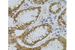 Immunohistochemistry of paraffin-embedded Human stomach using SIGMAR1 Polyclonal Antibody (SIGMAR1 抗体)