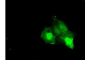 Anti-KHK mouse monoclonal antibody (ABIN2453198) immunofluorescent staining of COS7 cells transiently transfected by pCMV6-ENTRY KHK (RC202424). (Ketohexokinase 抗体)